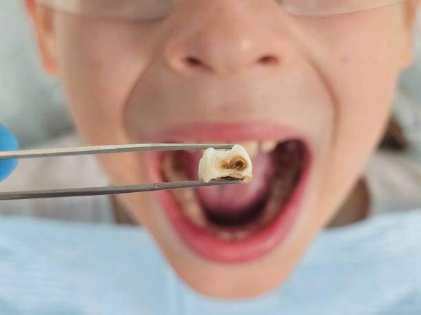 Best Cosmetic Emergency Dentistry in Arroyo Grande, CA